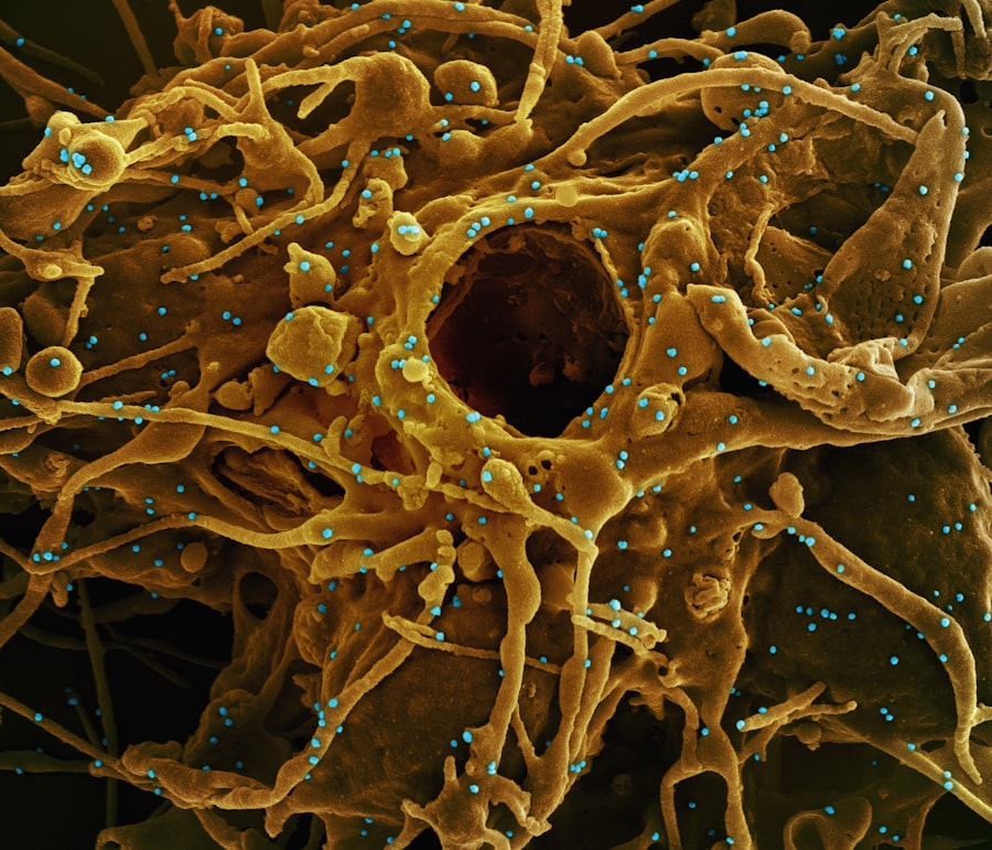 lipogenesis
