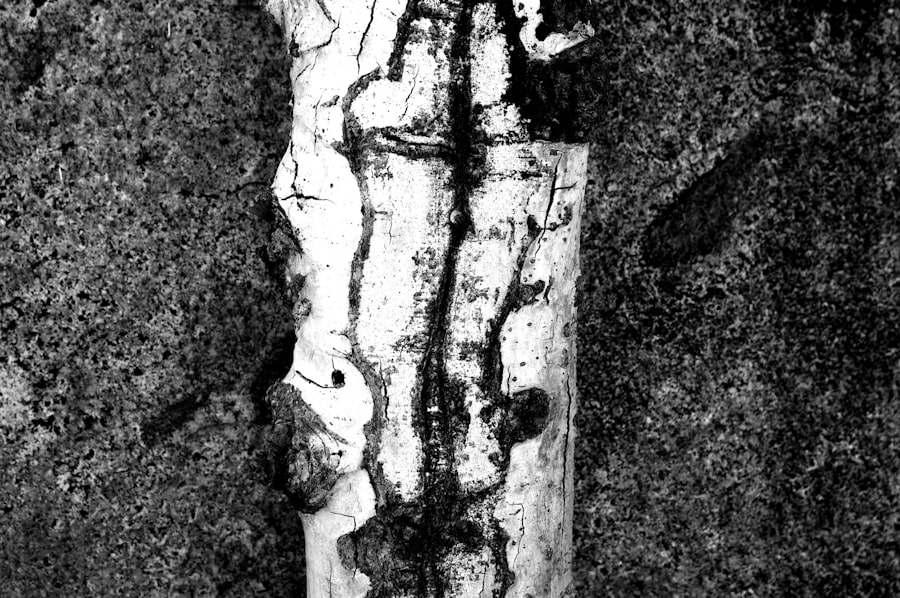 sarcopenia