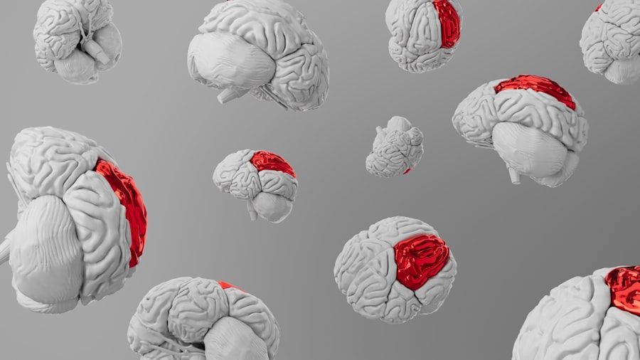 brain health