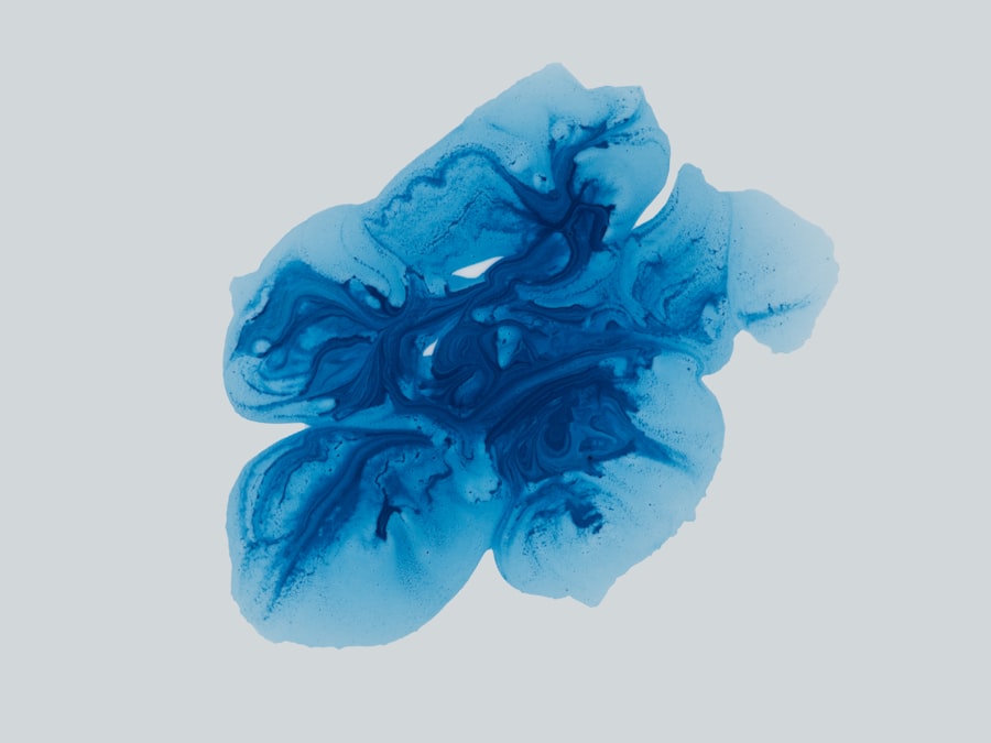 aging brain