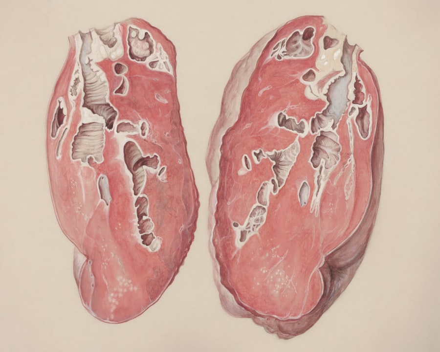 liver damage