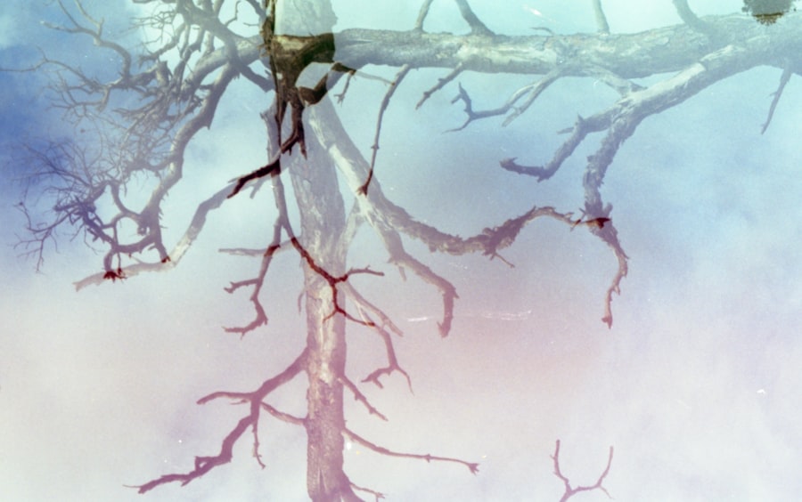 parasympathetic nervous system activation