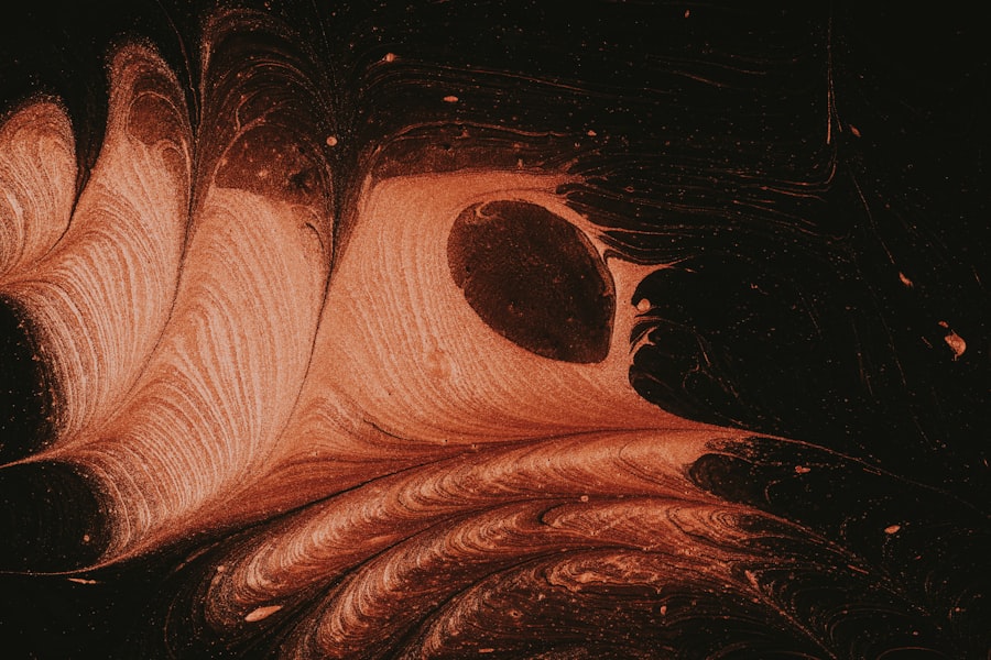 Sarcopenia