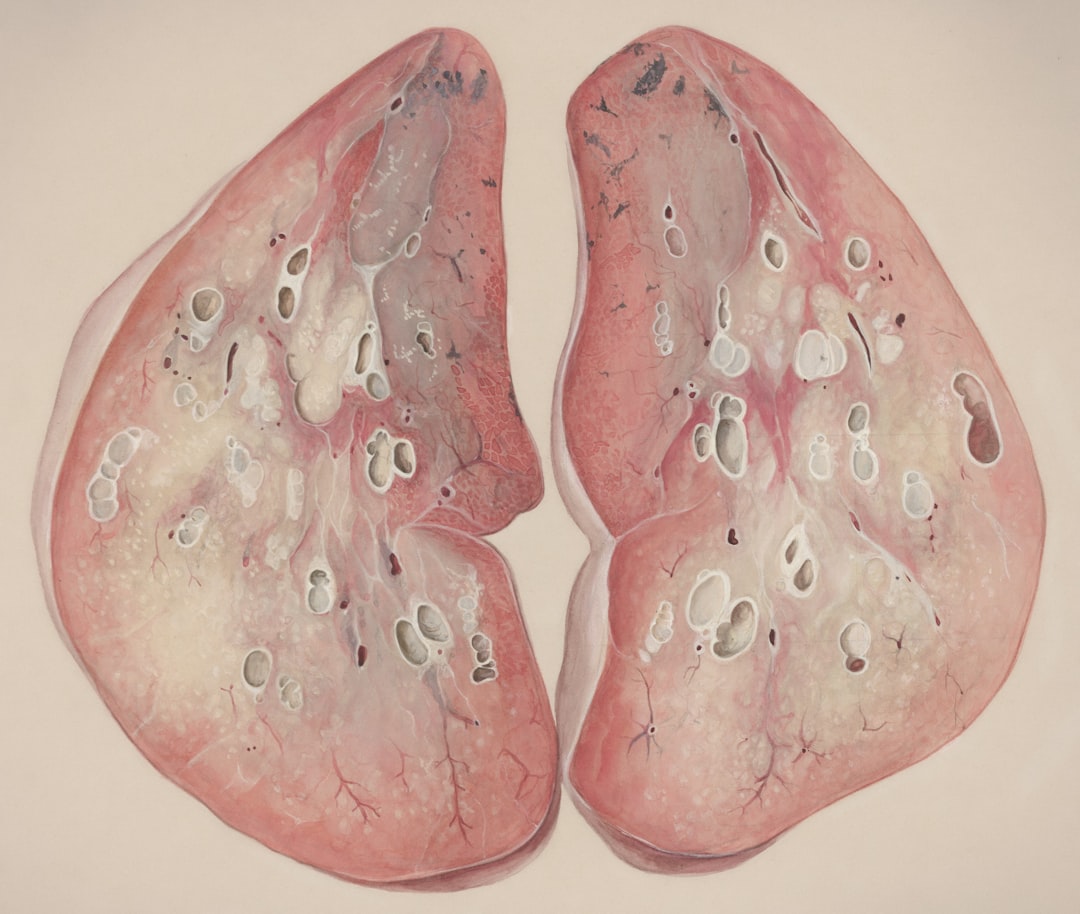 Photo fatty liver disease