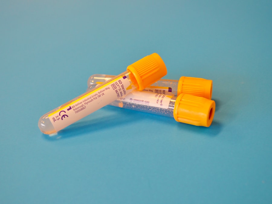 Photo insulin resistance