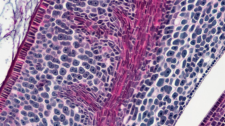 Photo lipogenesis