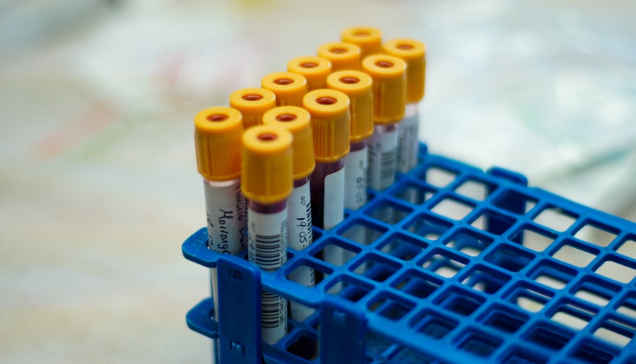 Photo hemochromatosis testing