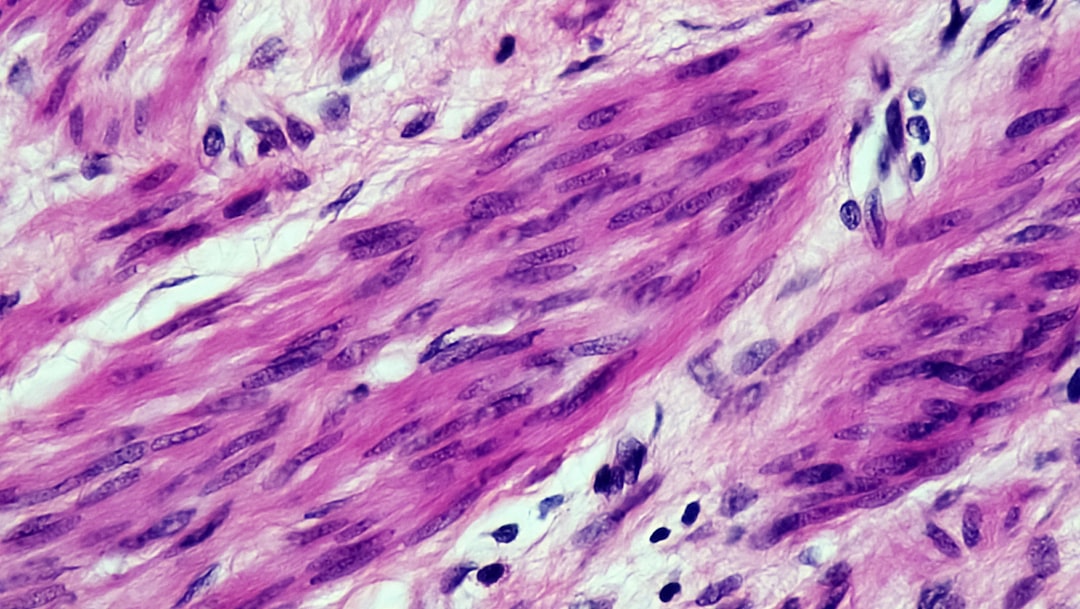 Photo curcumin bioavailability