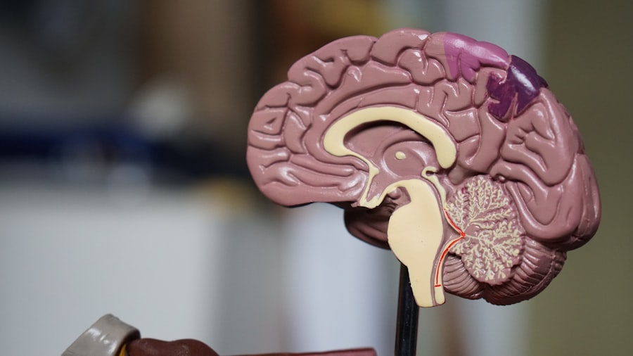 Photo brain health