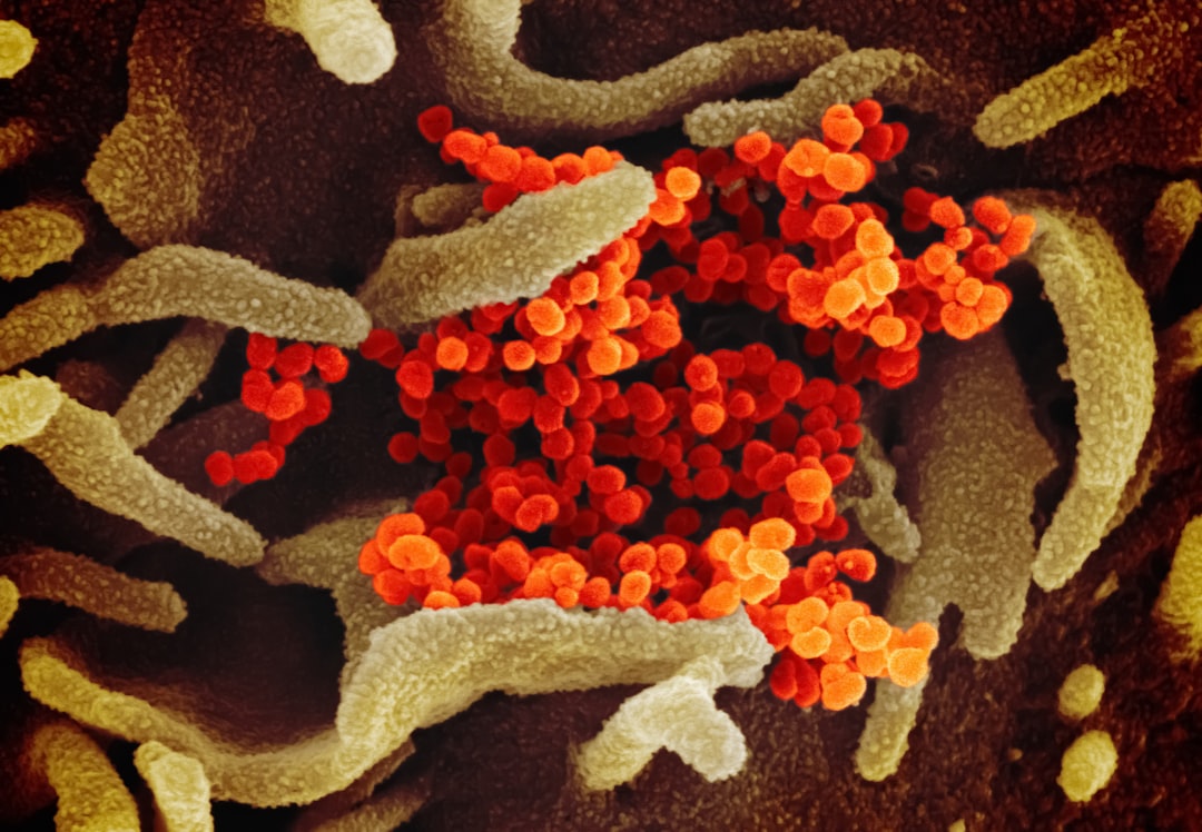 Photo Homocysteine Levels