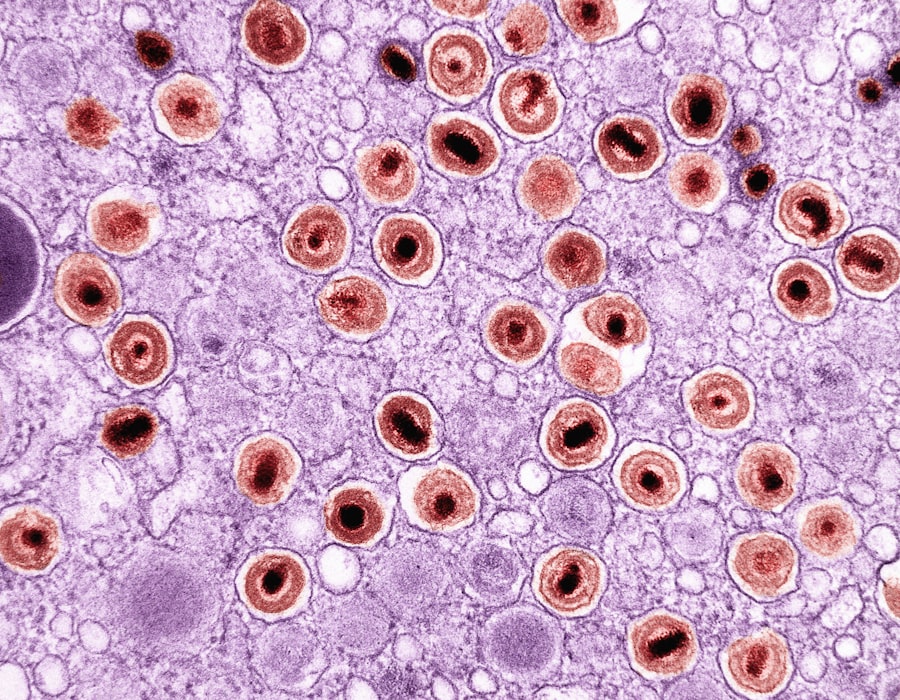 Photo Homocysteine Levels