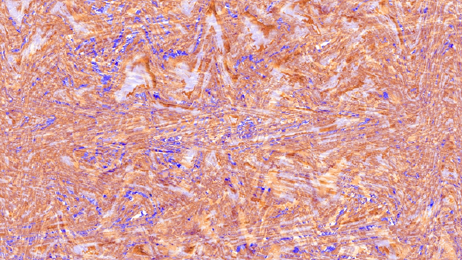 Photo B12 Neuropathy