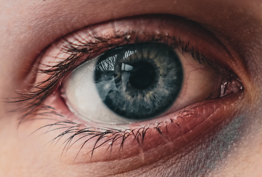 Photo medicare vision loss