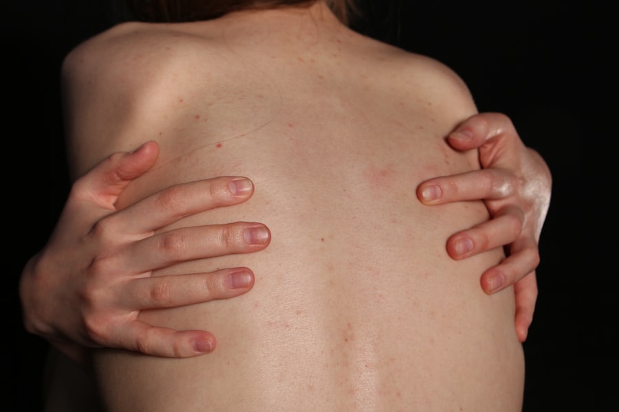 vagus nerve symptoms