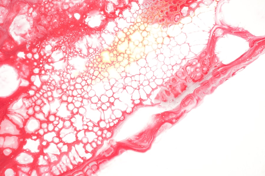Photo Endothelium damage