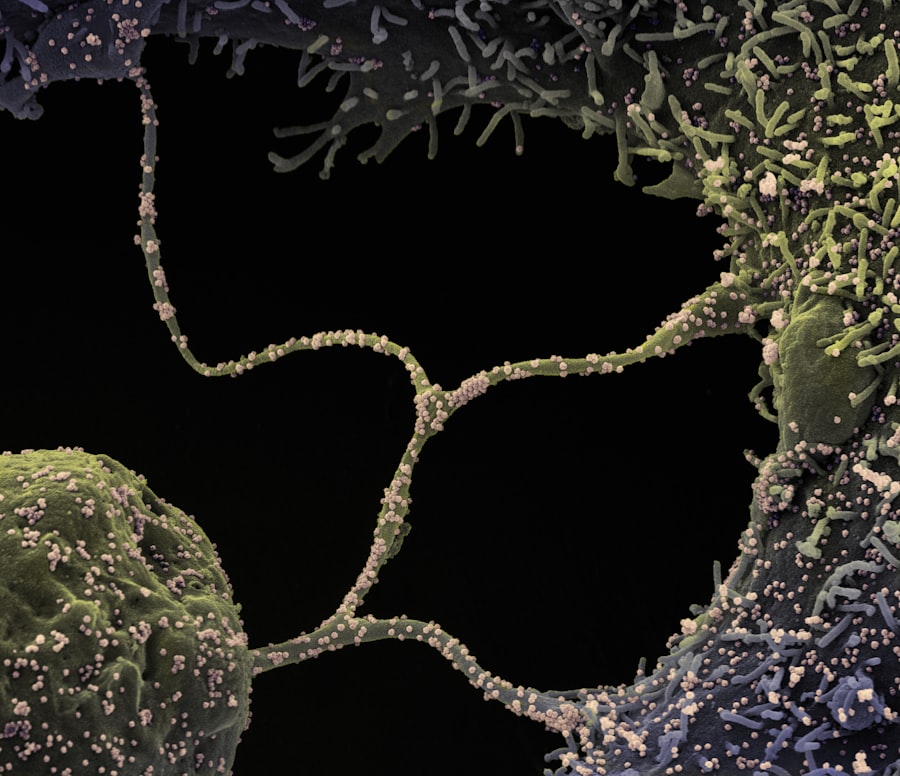 Photo clear amyloid proteins
